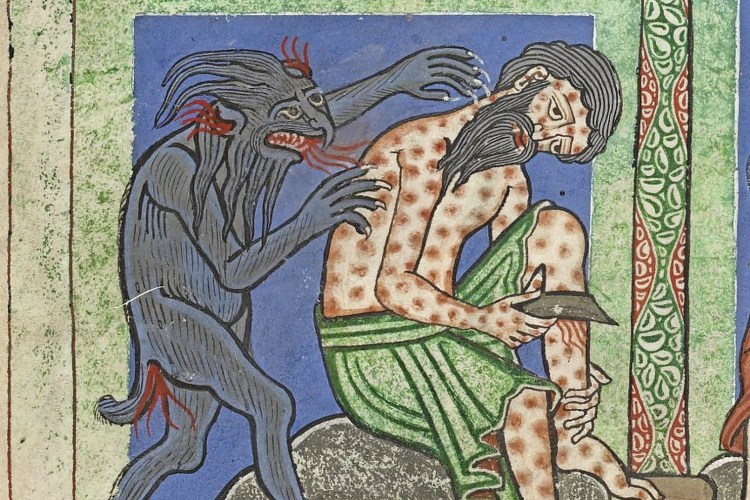 In the Middle Ages leprosy was regarded as a divine blessing
